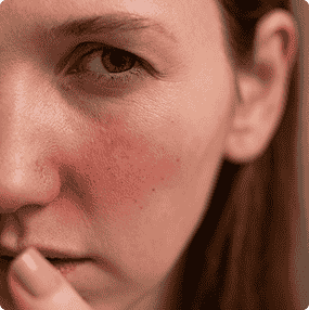 Loss of Firmness & Contour