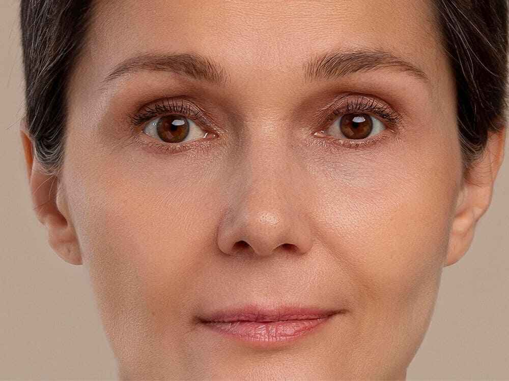 FREE CONSULTATION AFTER