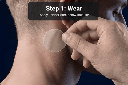 TrichoPatch+ 7-Day Trial (Men’s Scalp Care)