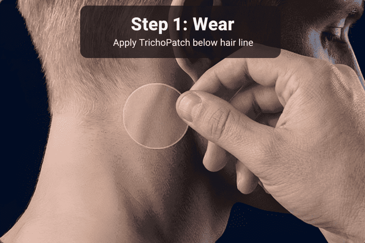 step 1 : how to wear and apply trichopatch below hair line